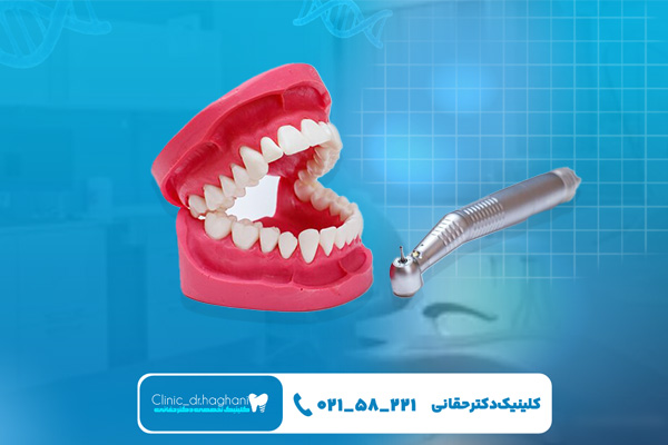 دندانپزشکی اقساطی