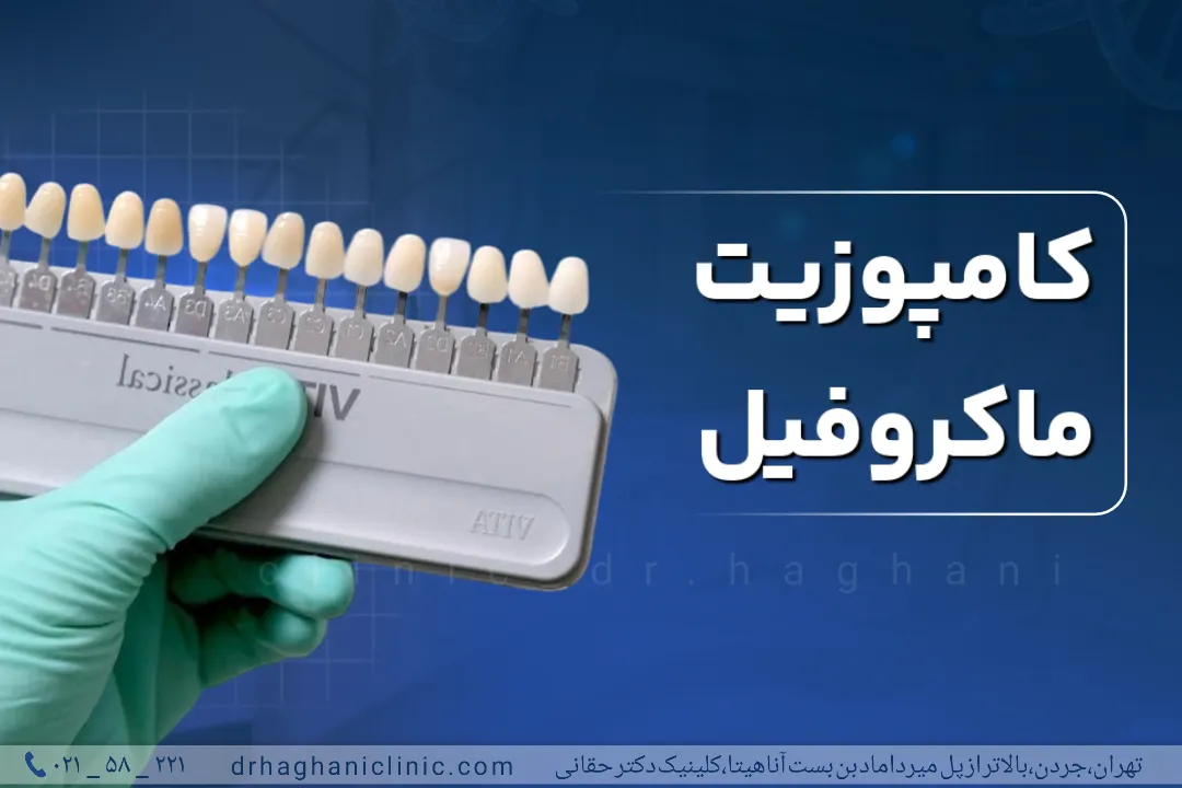 کامپوزیت ماکروفیل