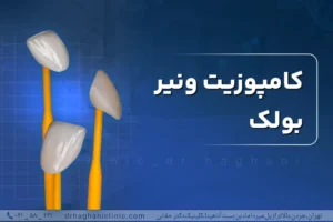 کامپوزیت ونیر بولک