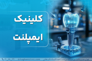 کلینیک ایمپلنت