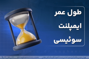 طول عمر ایمپلنت سوئیسی