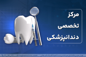 ایمپلنت اقساطی شمال تهران