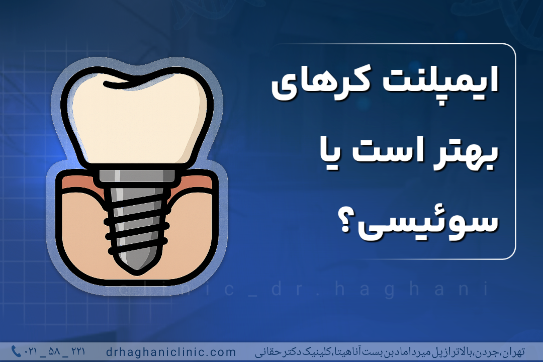 ایمپلنت کرهای بهتر است یا سوئیسی