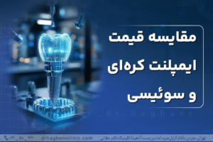 مقایسه قیمت ایمپلنت کره ای و سوییسی
