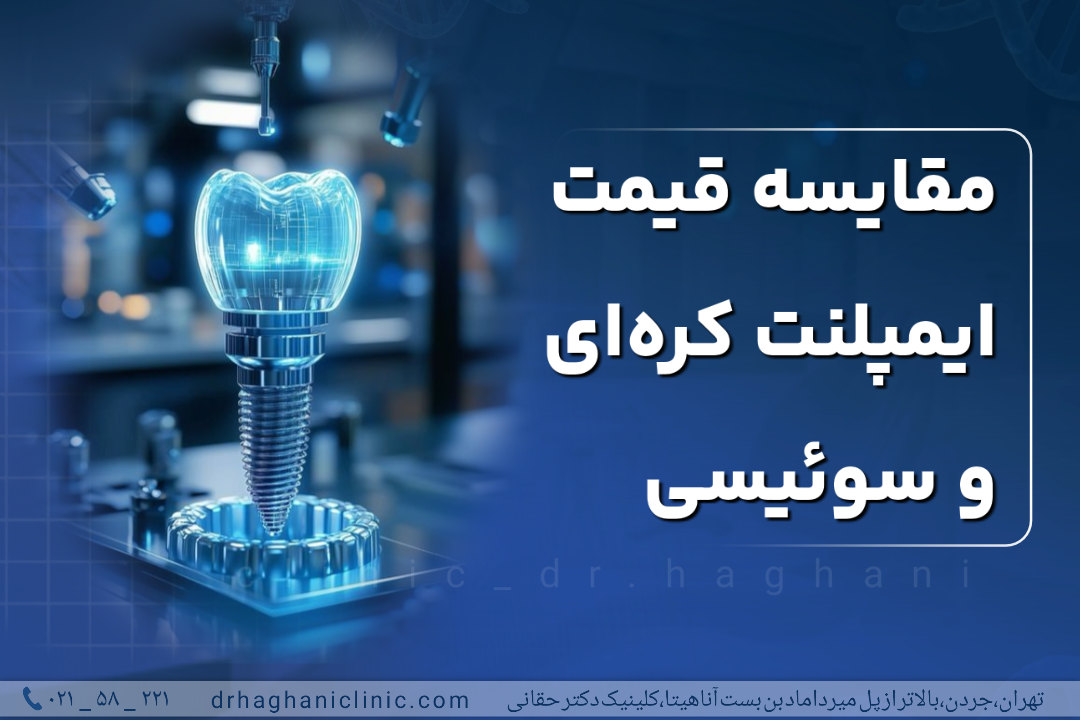 مقایسه قیمت ایمپلنت کره ای و سوییسی