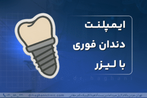 ایمپلنت دنان فوری با لیزر