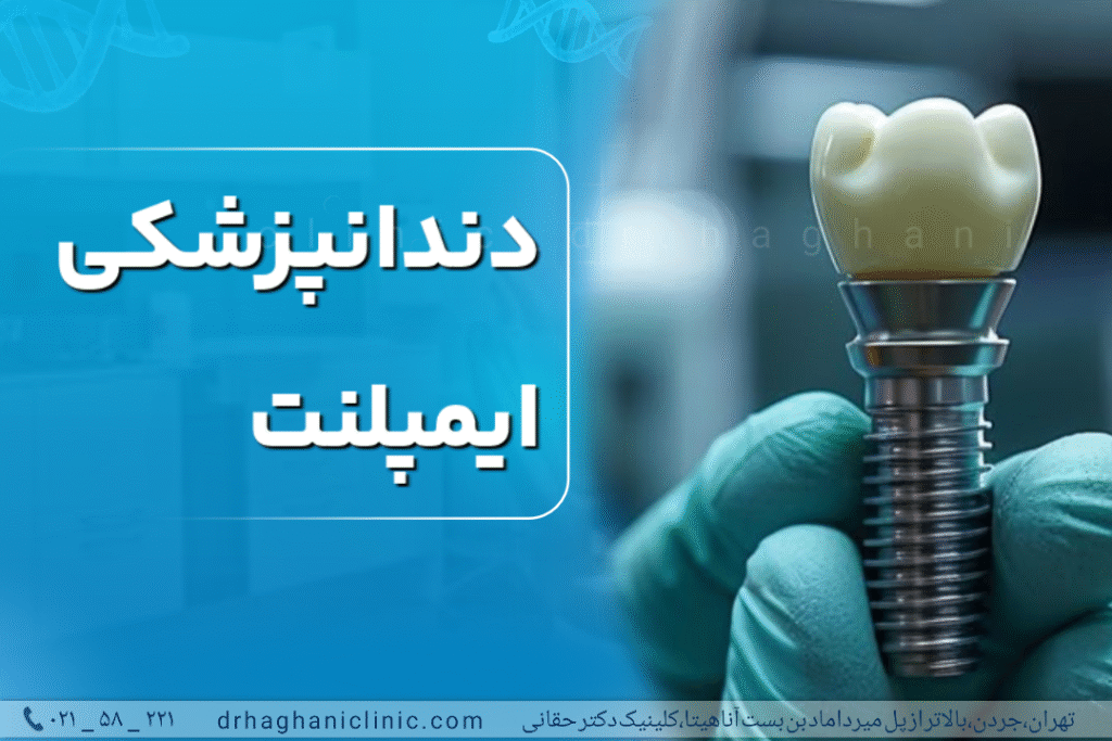 دندانپزشکی ایمپلنت‌