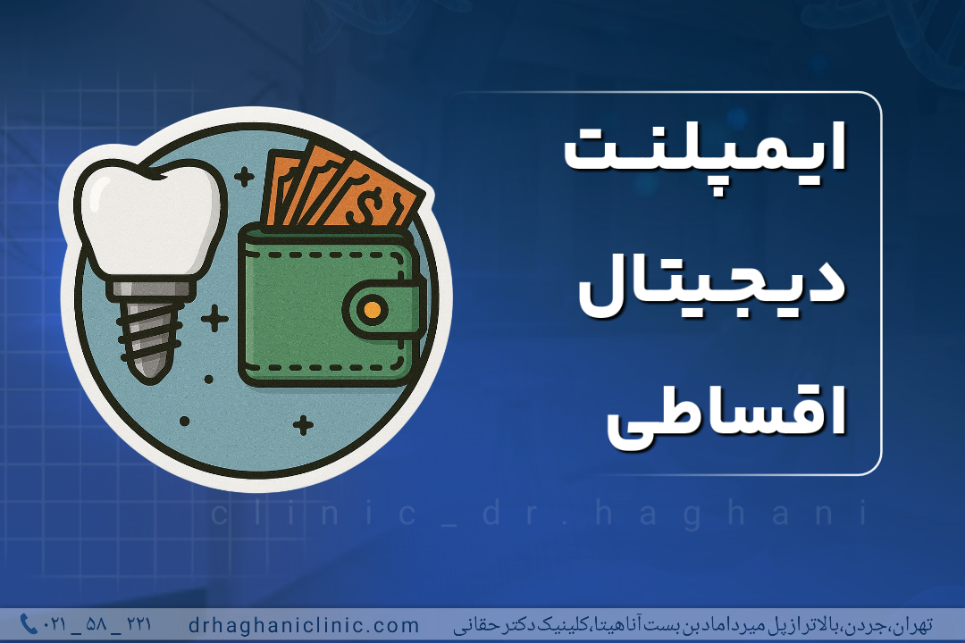 ایمپلنت دیجیتال قسطی
