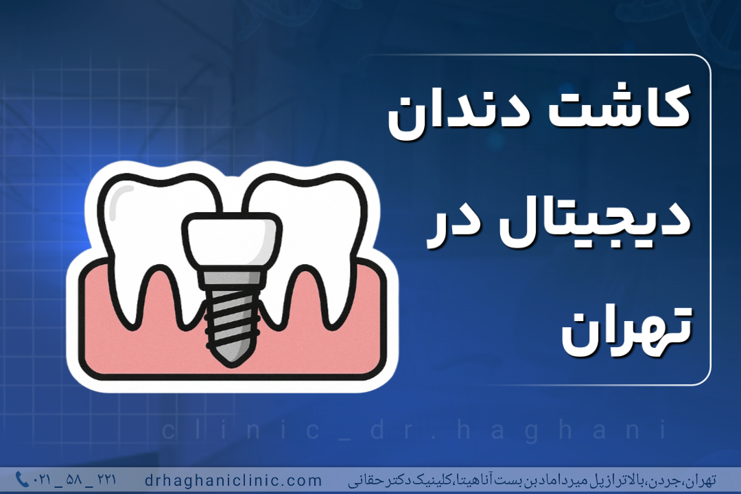 کاشت دندان دیجیتال در تهران