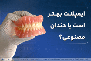 ایمپلنت بهتر است یا دندان مصنوعی