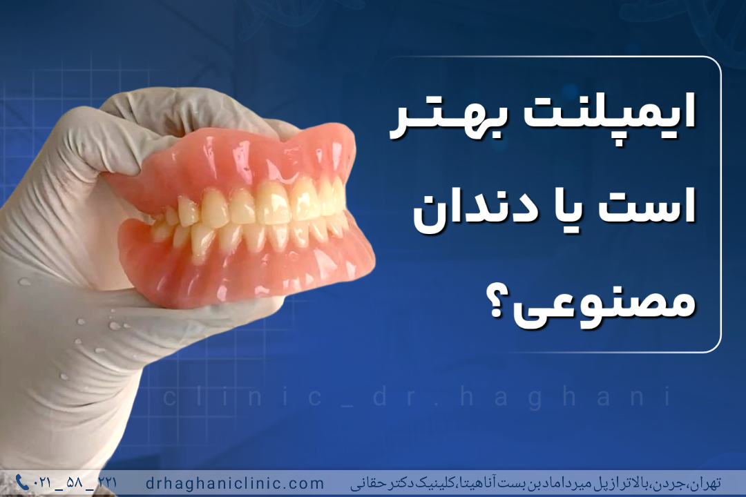 ایمپلنت بهتر است یا دندان مصنوعی