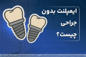ایمپلنت بدون جراحی چیست؟