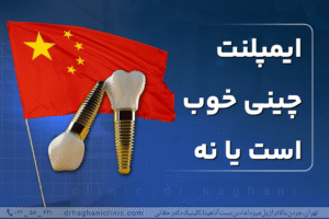 ایمپلنت چینی خوب است یا نه؟
