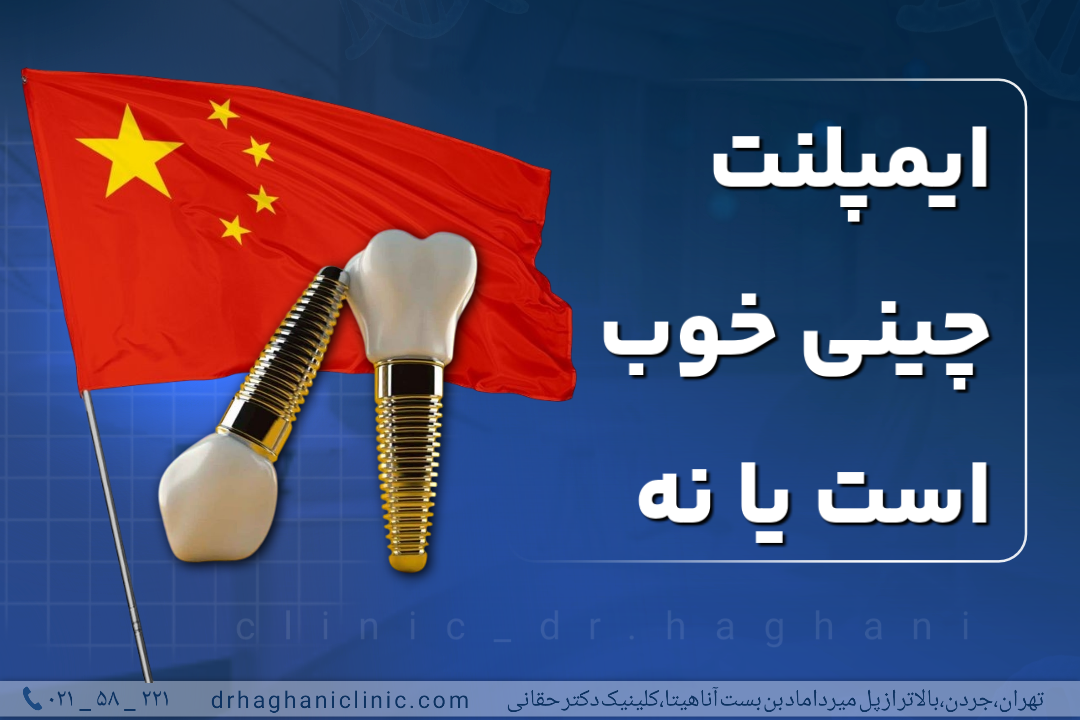 ایمپلنت چینی خوب است یا نه؟
