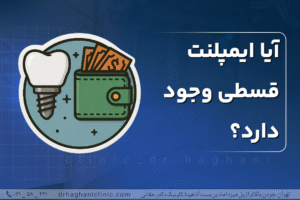 آیا ایمپلنت‌ قسطی وجود دارد؟