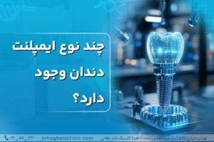 چند نوع ایمپلنت دندان وجود دارد؟