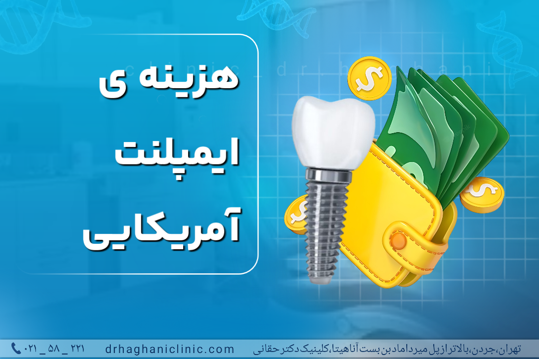 هزینه ایمپلنت آمریکایی