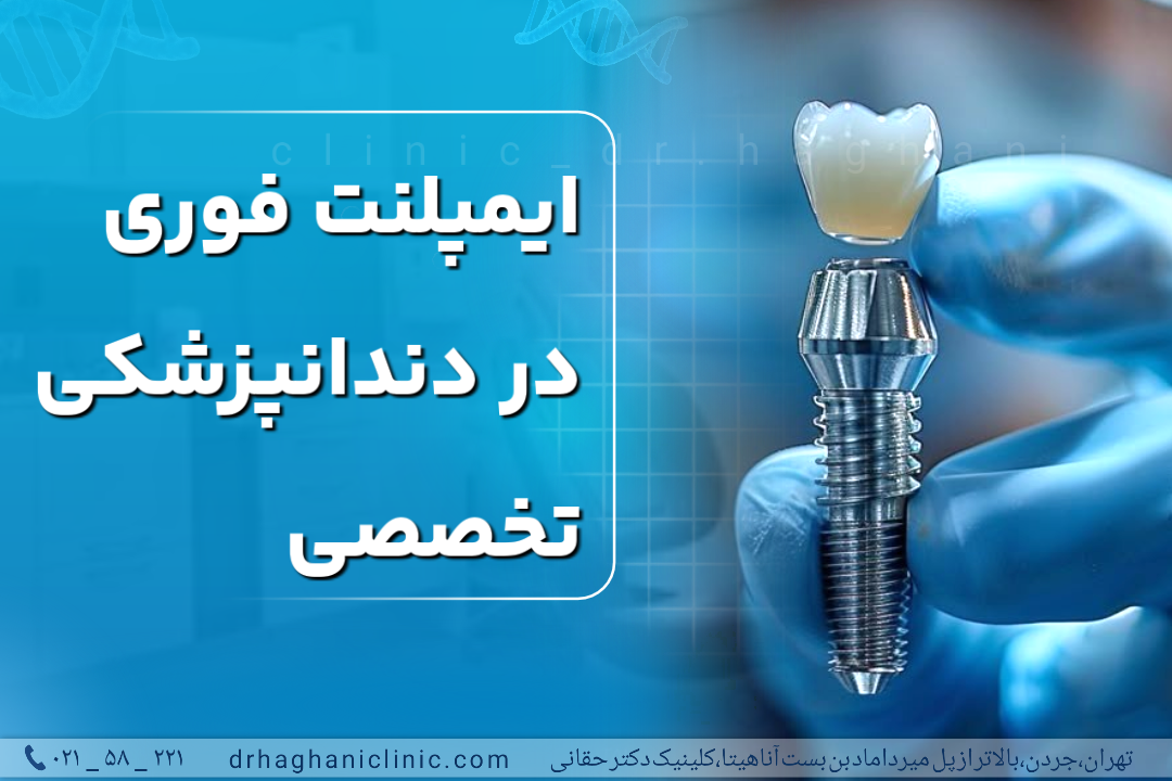 ایمپلنت فوری در دندانپزشکی تخصصی