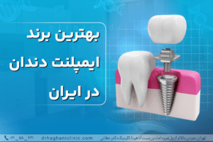 بهترین روش کاشت ایمپلنت در ایران