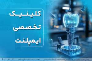 کلینیک تخصصی ایمپلنت
