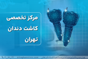 مرکز تخصصی کاشت دندان تهران