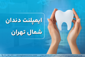 ایمپلنت دندان در شمال تهران