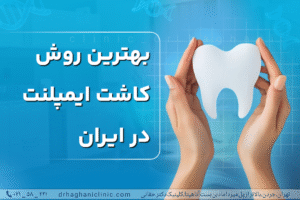 بهترین برندهای ایمپلنت دندان و راهنمای انتخاب