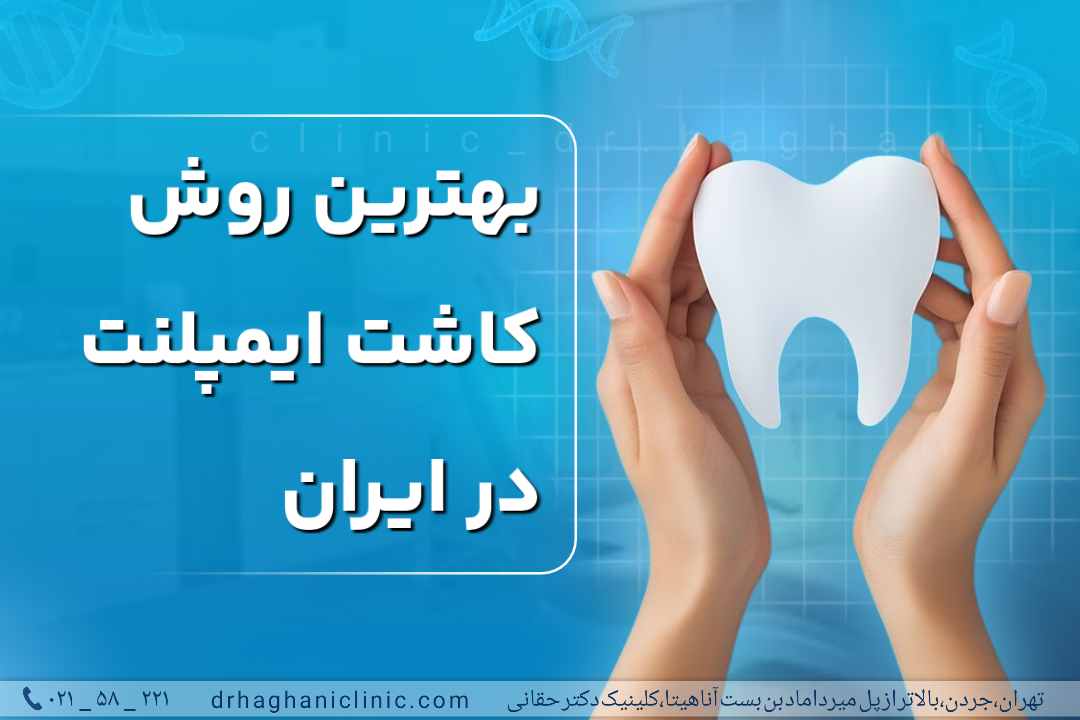 بهترین برندهای ایمپلنت دندان و راهنمای انتخاب
