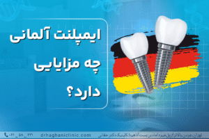 ایمپلنت آلمانی چه مزایایی دارد؟