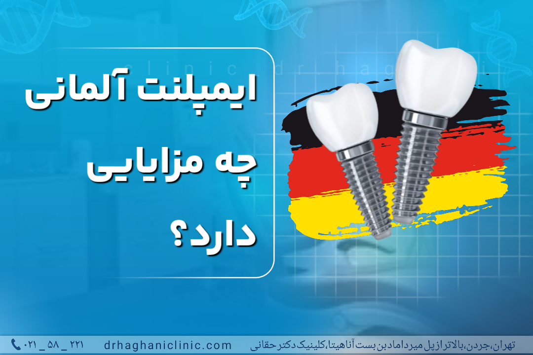 ایمپلنت آلمانی چه مزایایی دارد؟