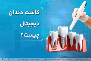 کاشت دندان دیجیتال