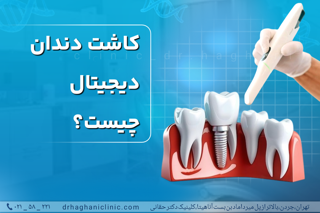 کاشت دندان دیجیتال