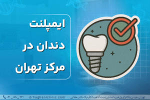ایمپلنت دندان در مرکز تهران