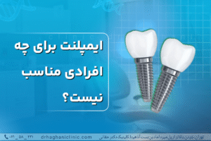 ایمپلنت برای چه افرادی مناسب نیست؟
