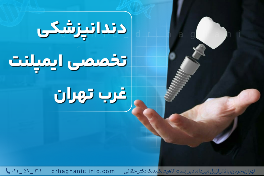دندانپزشکی تخصصی ایمپلنت غرب تهران