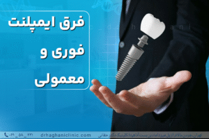 فرق ایمپلنت فوری و معمولی