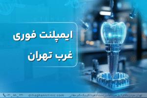 ایمپلنت فوری غرب تهران