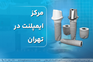 مرکز ایمپلنت در تهران