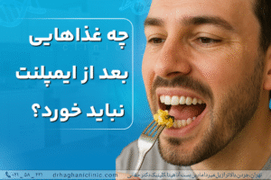 چه غذاهایی بعد از ایمپلنت نباید خورد؟