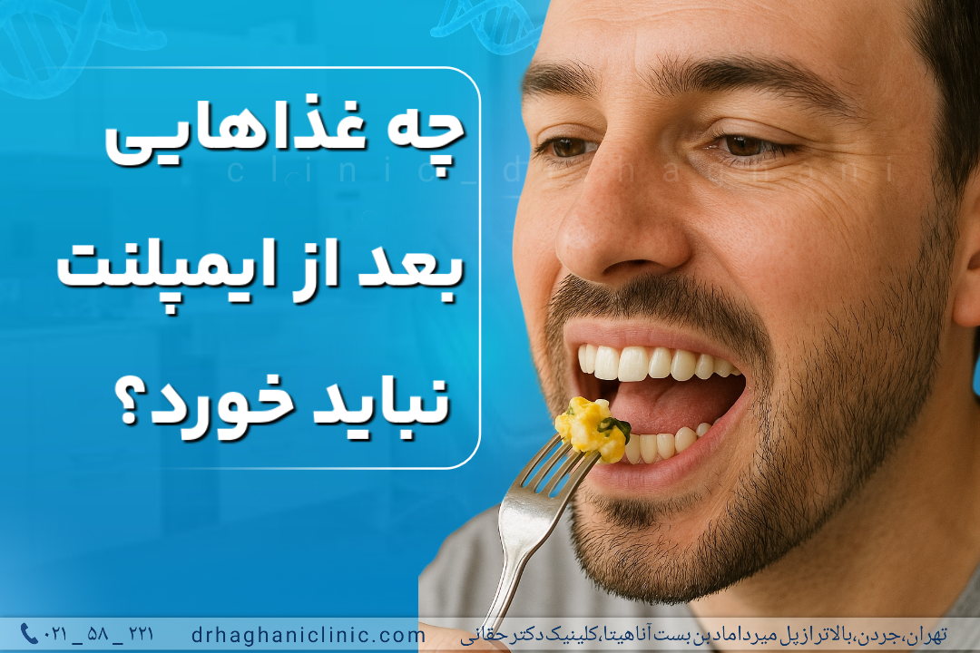 چه غذاهایی بعد از ایمپلنت نباید خورد؟