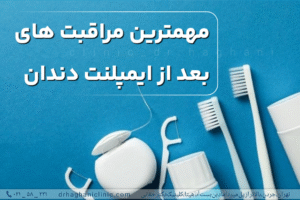 مهمترین مراقبت های بعد از ایمپلنت دندان