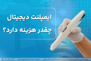 ایمپلنت دیجیتال چقدر هزینه دارد؟