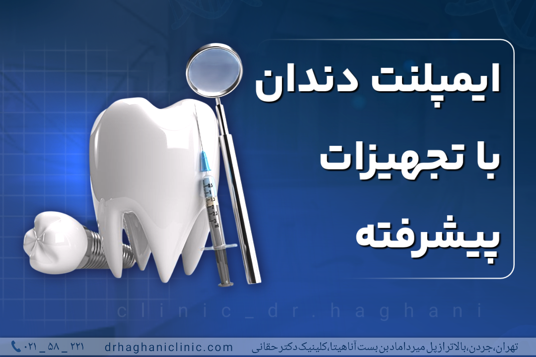 ایمپلنت دندان با تجهیزات پیشرفته دیجیتال