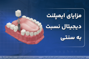 مزایای ایمپلنت دیجیتال نسبت به سنتی
