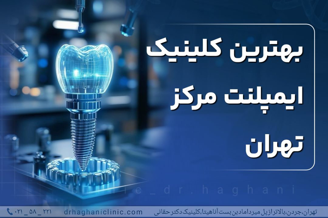 بهترین کلینیک ایمپلنت مرکز تهران
