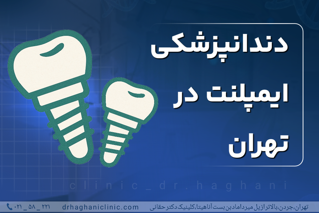 دندانپزشکی ایمپلنت در تهران