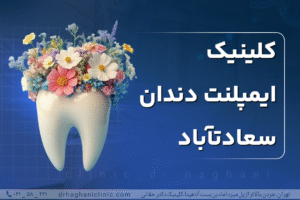 کلینیک ایمپلنت دندان سعادت آباد