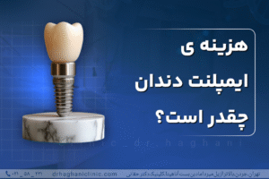 هزینه ایمپلنت‌ دندان چقدر است؟