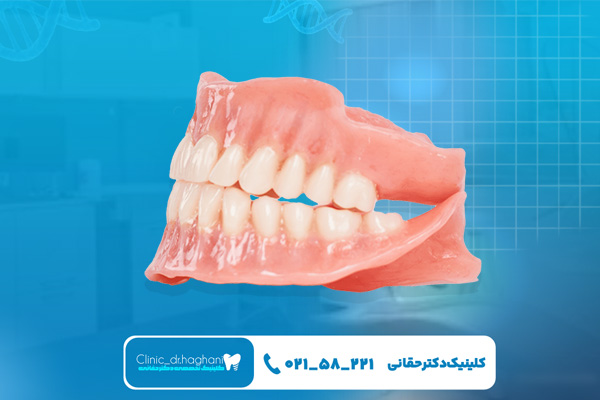 ایمپلنت دندان و دندان مصنوعی در سلامت لثه و استخوان ایمپلنت دندان و دندان مصنوعی در سلامت لثه و استخوان