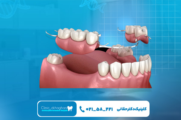  بهترین دندانپزشک برای انجام پروتز دندان
